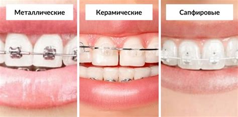 Строительство Дома
