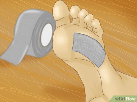 5 Ways to Remove Verrucas - wikiHow