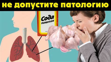Сода и Чеснок Спасли Меня От Мокроты в Лёгких и Бронхита! Рецепт ...