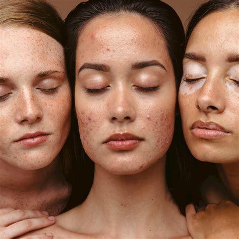 british skin foundation  itn business launch skin   surface