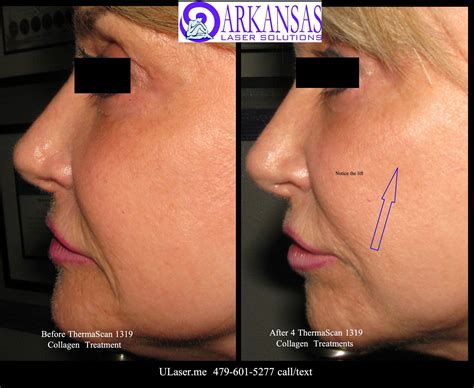 Arkansas Laser Solutions