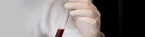 Order Your Tests | Laboratory Services in Florida | Citywide Medical Lab