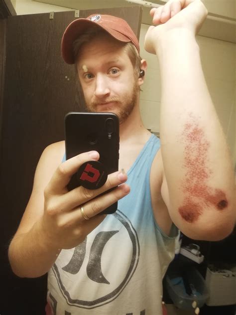 Back tires slipped on wet pavement and now I have rather unfortunate