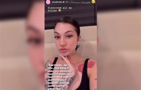 Bhad Bhabie Warns Against Facial Fillers After Dissolving Her Own