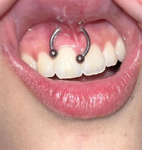 smiley piercing unveil  trendy secret