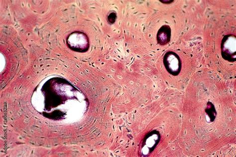 Histology of human compact bone tissue under microscope view for ...