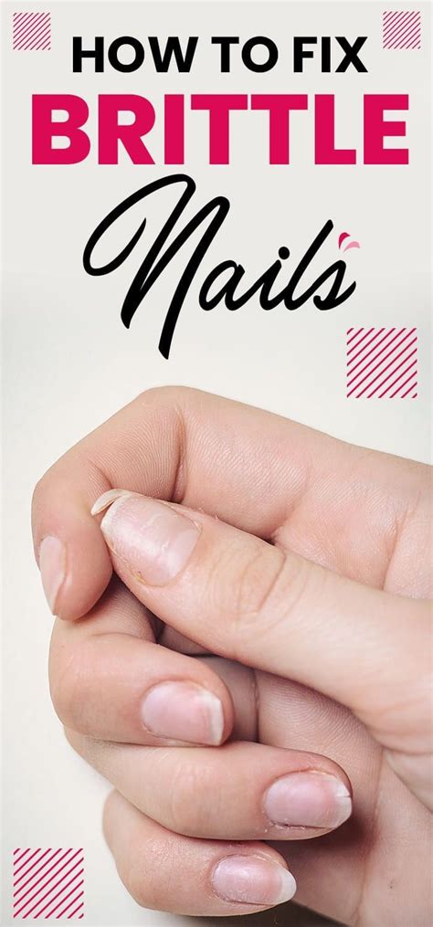 Understanding Brittle Nails: Causes, Symptoms, and Treatment Options ...