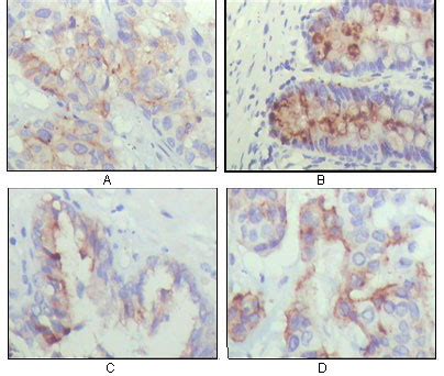 igfbp antibody ammg leading biology leading biology