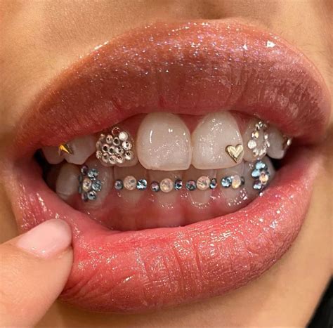 teeth gem aesthetic tooth gem dental jewelry pretty teeth