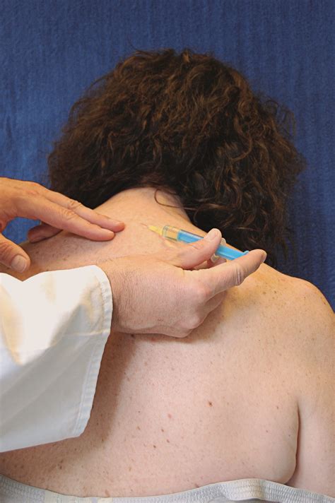 Medial Branch Nerve Blocks - Comprehensive MD