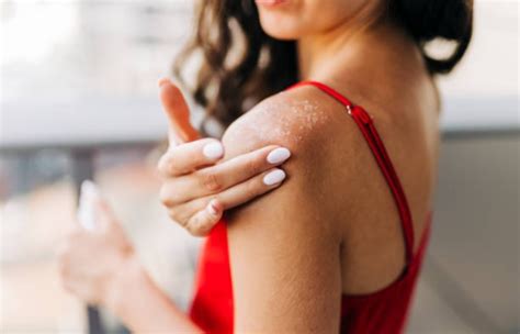 Allergic Reaction Rash – Meaning, Types, Symptoms, And More