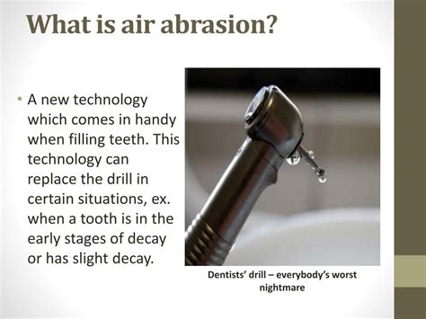 PPT - Air abrasion technology - For easy teeth filling PowerPoint