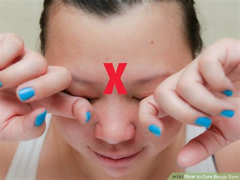 How to Cure Baggy Eyes: 10 Steps (with Pictures) - wikiHow