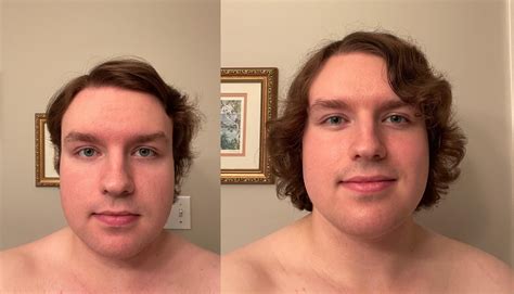 Face gains from 1 Day to 3 Months of HRT. My friends say I look like I