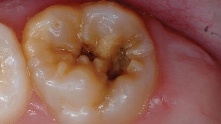 Berg Figure 1 - Oral Health Group