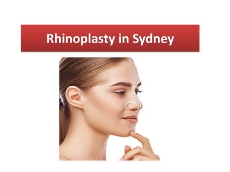 rhinoplasty  australia powerpoint