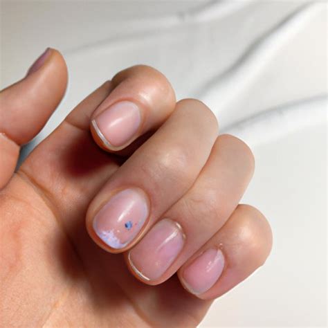 What is Nail Pitting? Overview, Symptoms, Causes and Treatments - The ...