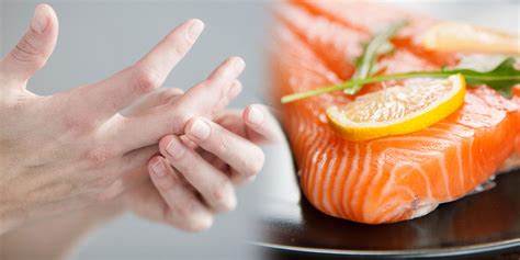 Most Common Foods Proven To Help With Arthritis - HealthPrep.com
