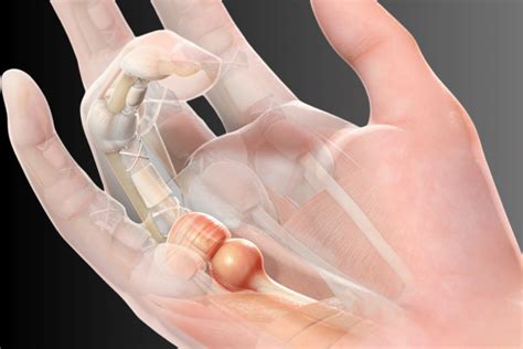 symptoms  trigger finger nhs