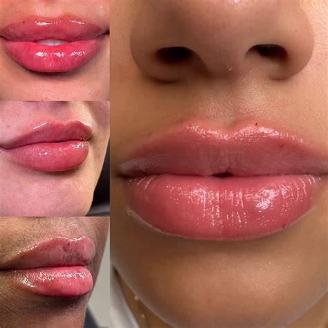 Kristen Acton,RN Aesthetic Injector - I’m only at the salon 3 more days