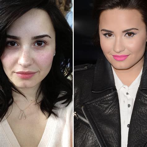 Demi Lovato Plastic Surgery Before And After