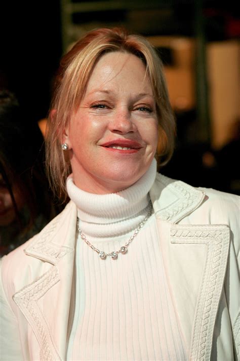 Melanie Griffith Leaves Bruises Exposed amid Cancer Battle & Removal of
