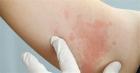 Different Types of Skin Conditions and Their Treatments – Skin bio