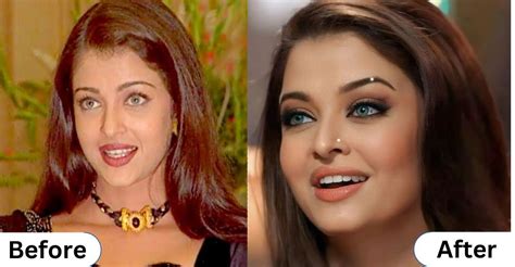 Aishwarya Rai: The Truth Behind Her Lip Filler Rumors