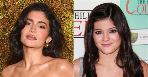kylie jenner complains  face     accepted