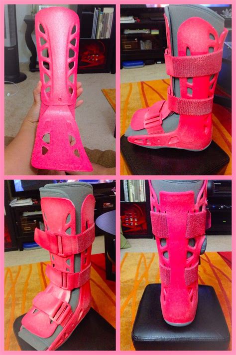 Broken Ankle Cast Colors