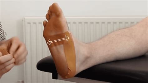 Plantar Fasciitis Taping | Video and Step-by-Step Guide