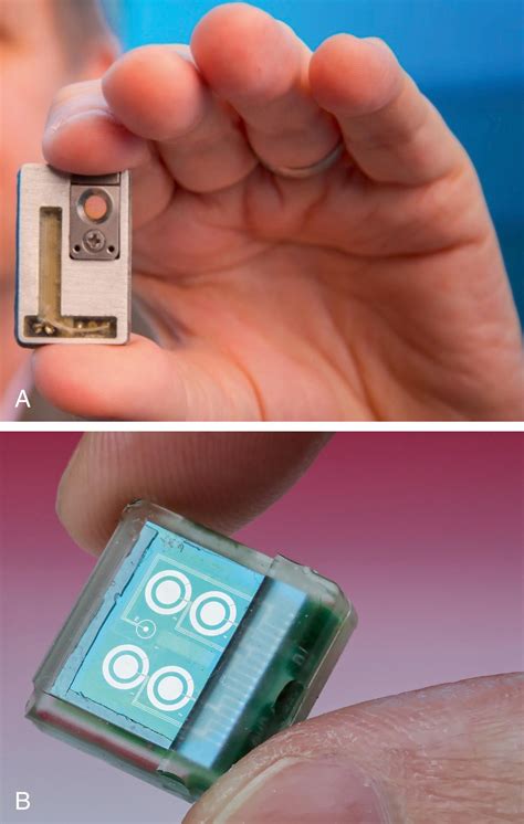 Biosensors in Neurosurgery: Wearable and Implantable Devices for