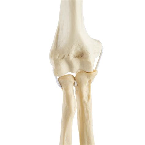 ellbogen links orthobones standard