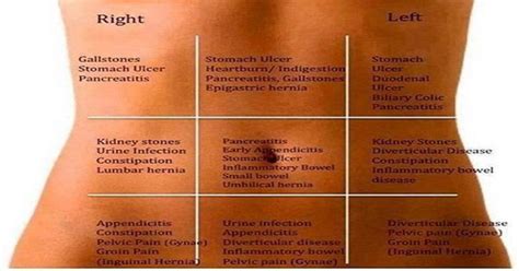 Abdominal and Stomach Pain Map: Understand Your Gut Pain