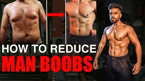How I Lost My MAN BOOBS & PUFFY NIPPLES | Step by Step Guide | Secret