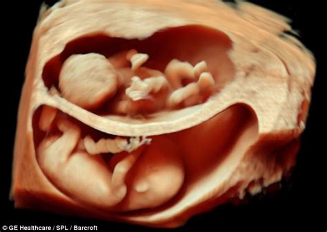 National Geographic: twins play in the womb - ClinicQuotes