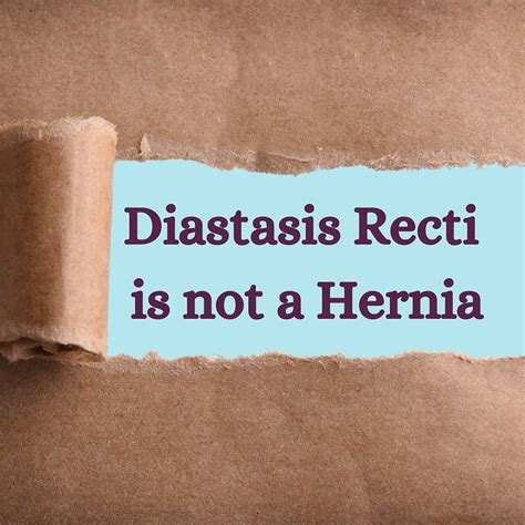 What is Diastasis Recti?