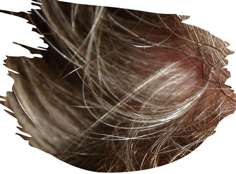 thinning hair menopause 10