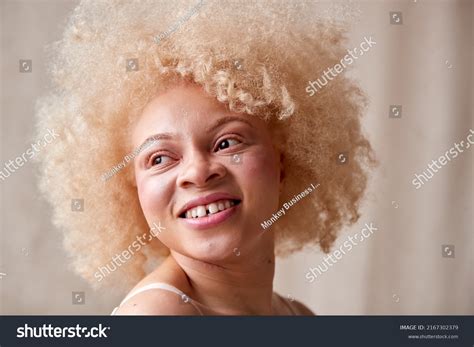 1,017 Albino Black Woman Images, Stock Photos, 3D objects, & Vectors ...