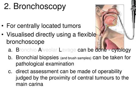 PPT - LUNG CANCER PowerPoint Presentation, free download - ID:1153530