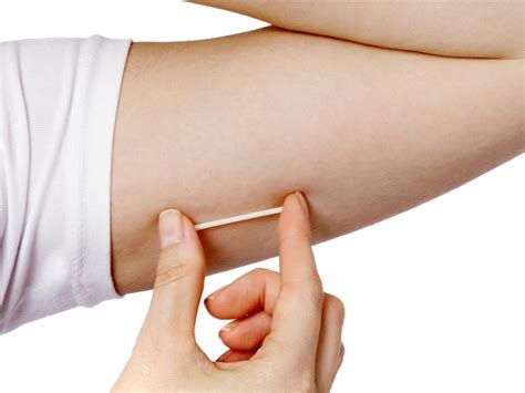 New implant device provides continuous birth control for up to three ...