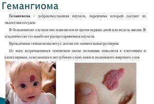 Хемангиом при новородени: причини, видове патология, методи на лечение