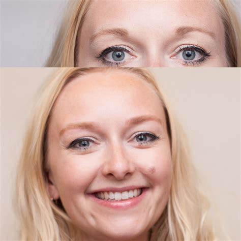 Download Bellesa We Gave Her Atm And Facial! : Our lovely patient is 3
