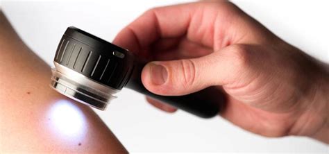 dermoscopy ii medscience