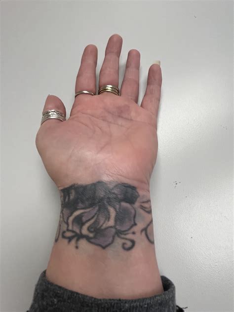 LONGVIEW ORTHOPEDIC ASSOCIATES - Longview WA - Hours, Directions