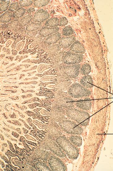 peyer's patch histology Diagram | Quizlet