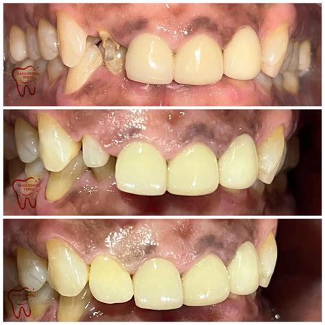 dr namratha nagesh  linkedin  case  post core   crown