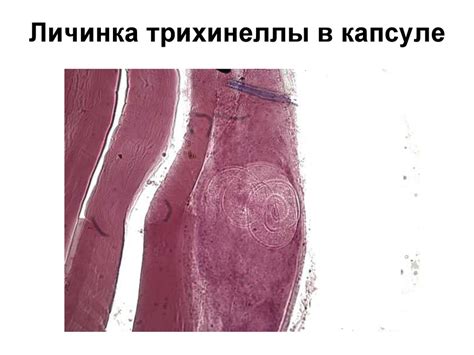 Трихинеллез. Трихинелла. Биологический цикл - презентация онлайн