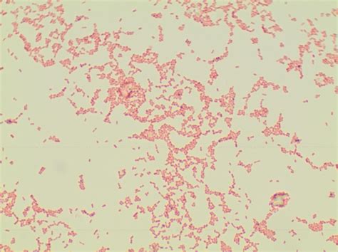 Lactobacillus plantarum Classification Model by Fecal Egg Counting