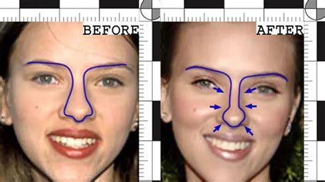 Scarlett Johansson’s Nose Job: From Childlike Cuteness To Ladylike ...